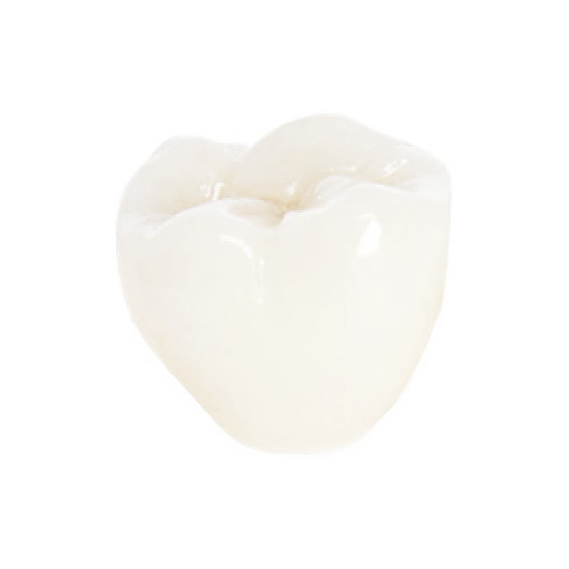 Coronas & puentes | MediMatch Laboratorio Dental